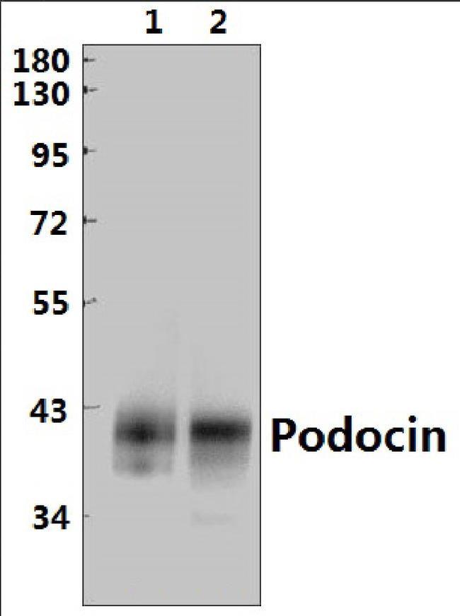 Podocin Antibody in Western Blot (WB)