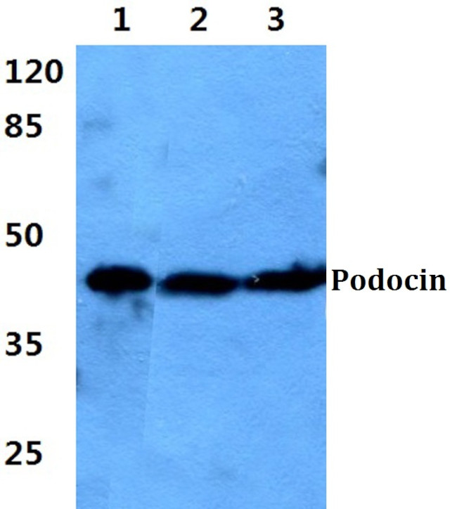 Podocin Antibody in Western Blot (WB)