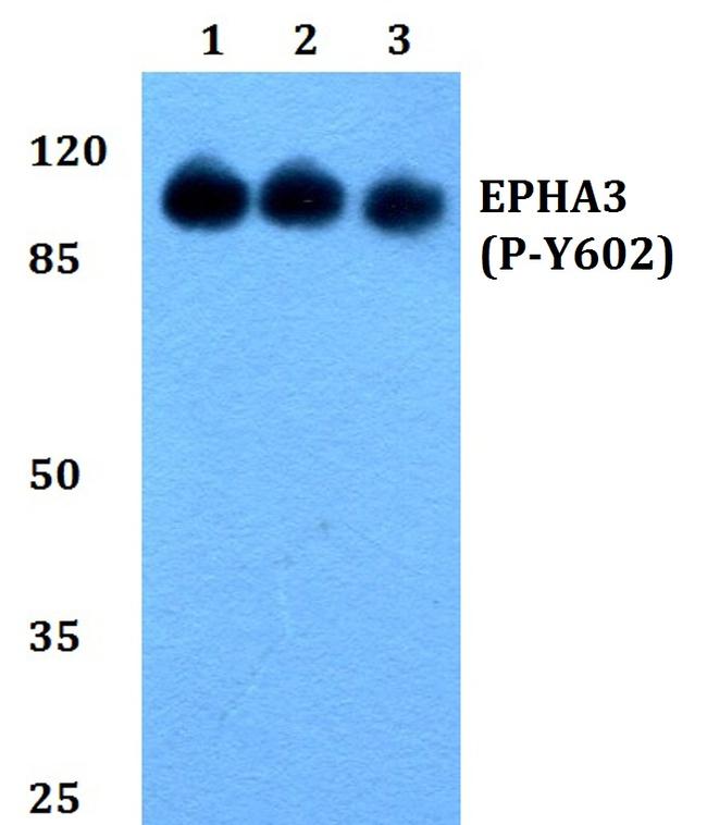 Phospho-EphA3 (Tyr602) Antibody in Western Blot (WB)
