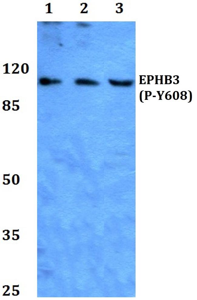 Phospho-EphB3 (Tyr608) Antibody in Western Blot (WB)