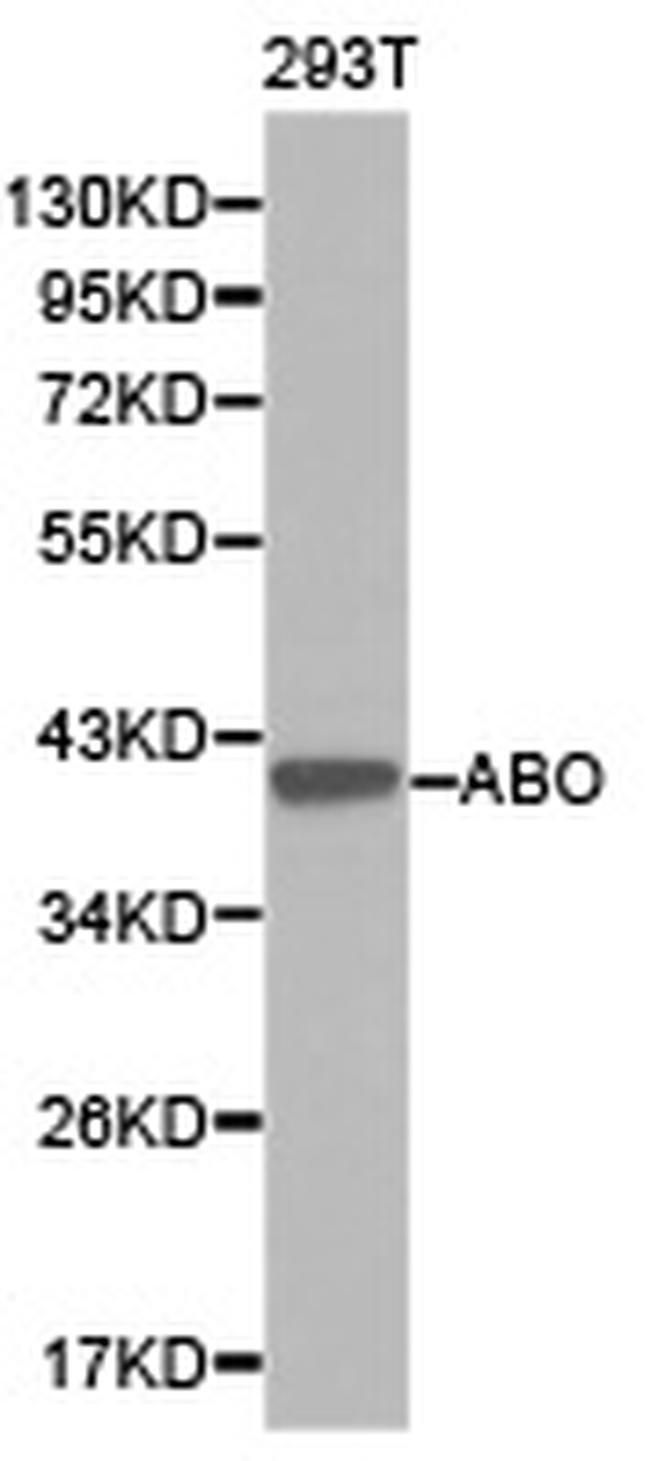 ABO Antibody in Western Blot (WB)