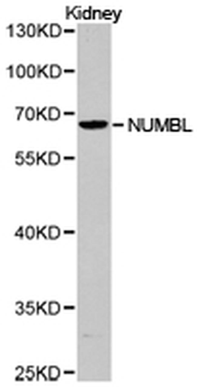 NUMBL Antibody in Western Blot (WB)