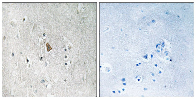 Phospho-IGF1R beta (Tyr1346) Antibody in Immunohistochemistry (Paraffin) (IHC (P))