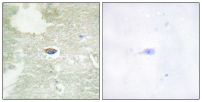 Phospho-TGFBR2 (Ser225, Ser250) Antibody in Immunohistochemistry (Paraffin) (IHC (P))