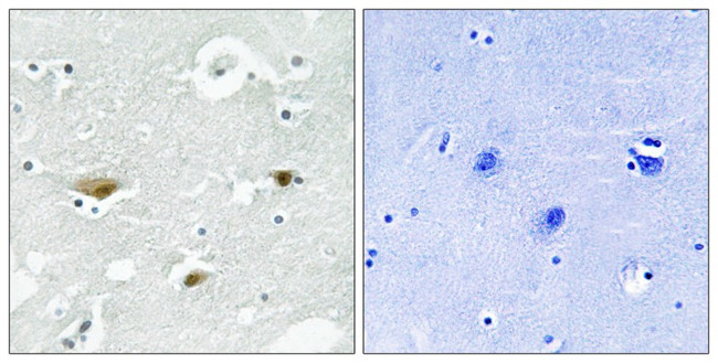 Phospho-STK39 (Ser323) Antibody in Immunohistochemistry (Paraffin) (IHC (P))