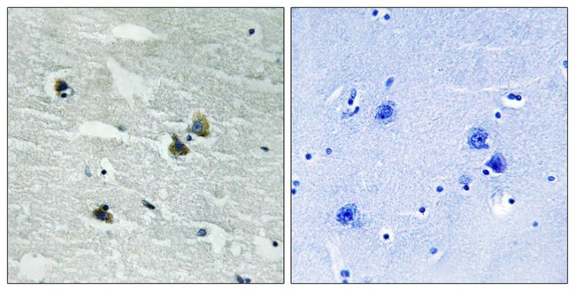 Phospho-MER/SKY (Tyr749, Tyr681) Antibody in Immunohistochemistry (Paraffin) (IHC (P))