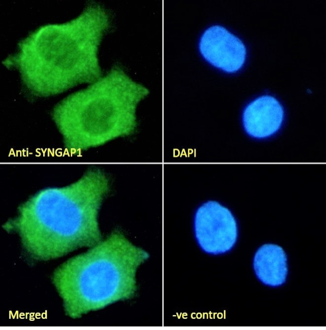 SynGAP Antibody in Immunocytochemistry (ICC/IF)