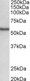 STK38 Antibody in Western Blot (WB)
