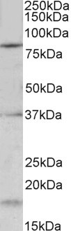 KV3.3 (KCNC3) Antibody in Western Blot (WB)