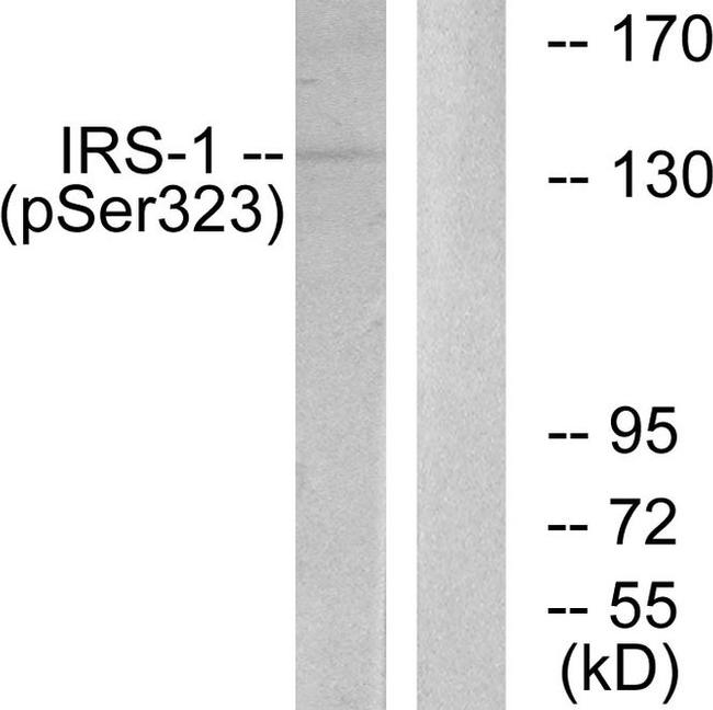 Phospho-IRS1 (Ser323) Antibody in Western Blot (WB)