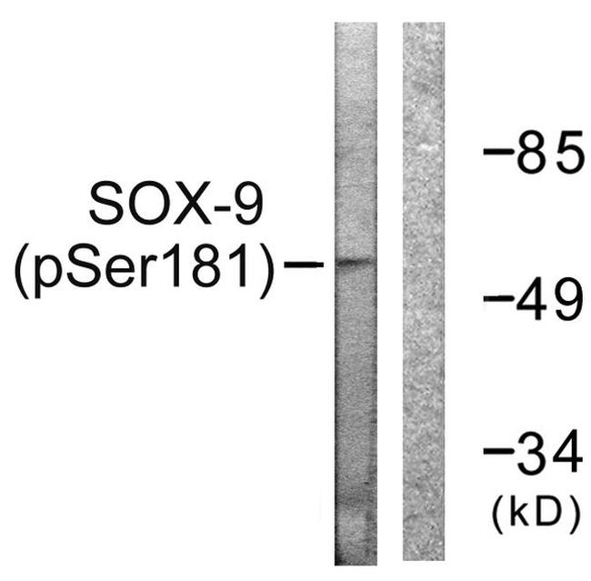 Phospho-SOX9 (Ser181) Antibody in Western Blot (WB)