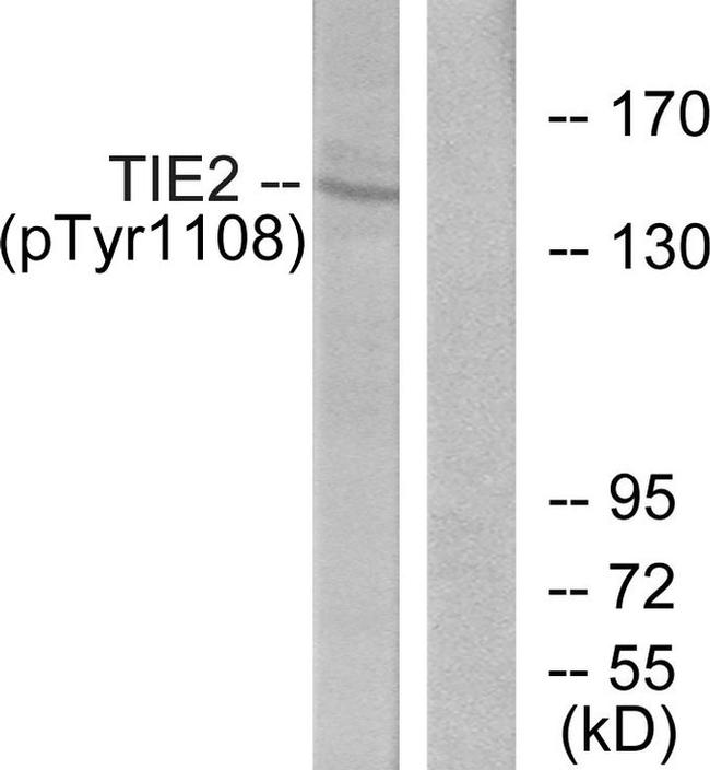 Phospho-TEK (Tyr1108) Antibody in Western Blot (WB)