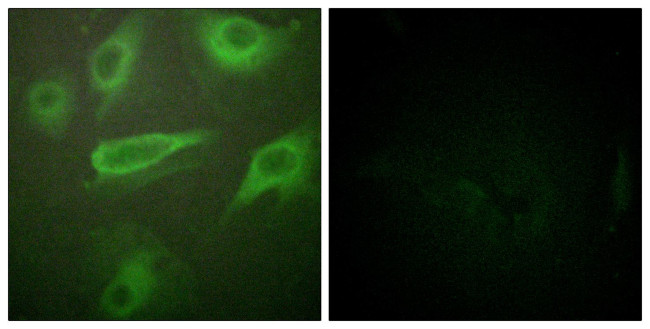 Phospho-IL4R (Tyr497) Antibody in Immunocytochemistry (ICC/IF)