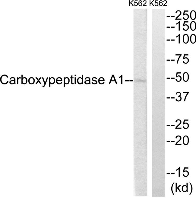 Carboxypeptidase A1 Antibody in Western Blot (WB)