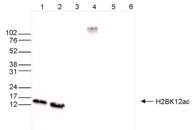 H2BK12ac Antibody in Western Blot (WB)