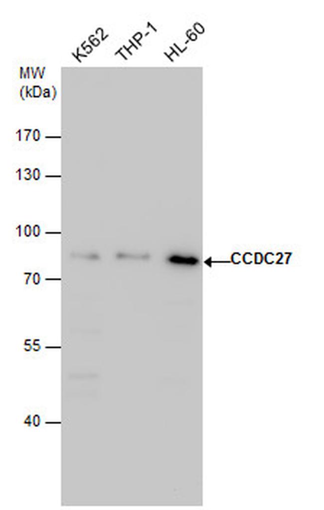 CCDC27 Antibody in Western Blot (WB)