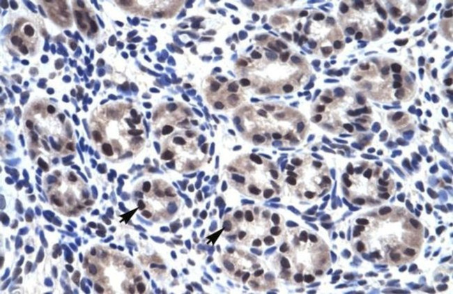 SP7 Antibody in Immunohistochemistry (IHC)