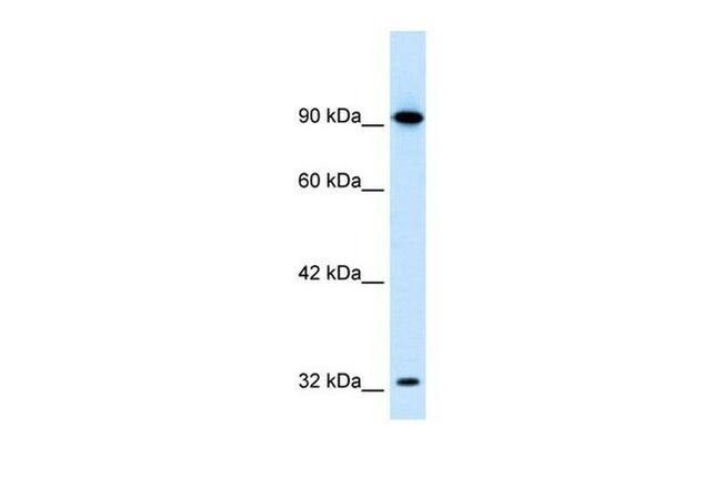 SOX30 Antibody in Western Blot (WB)