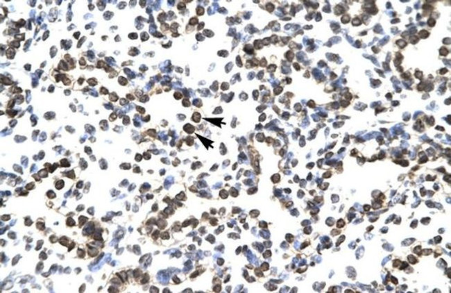 ZNF385A Antibody in Immunohistochemistry (IHC)