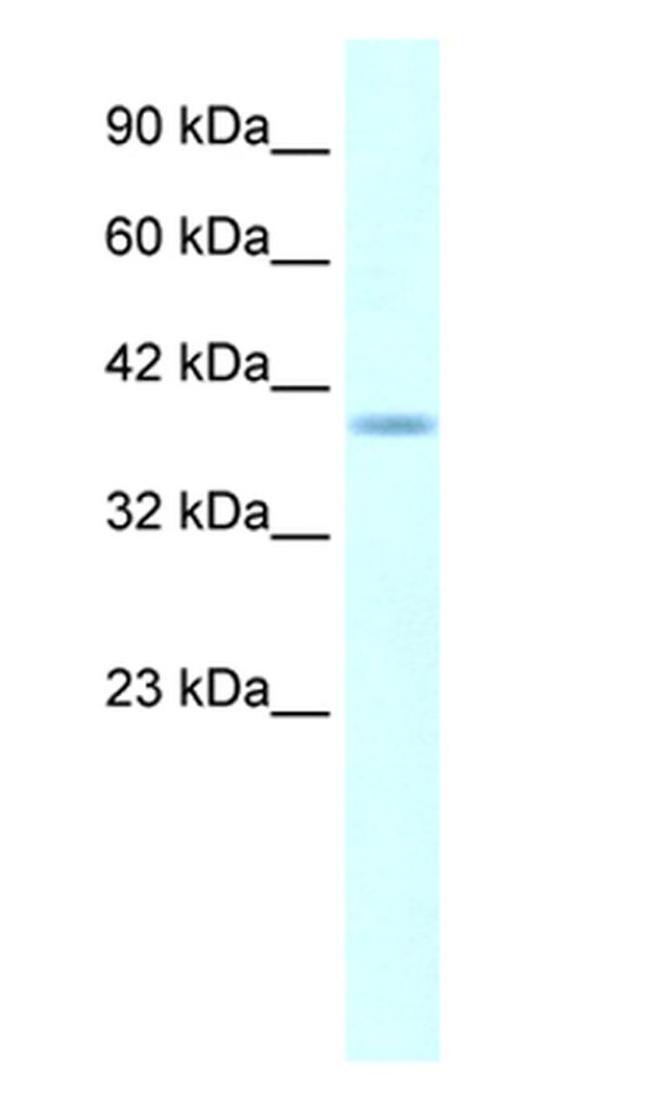 HMX1 Antibody in Western Blot (WB)