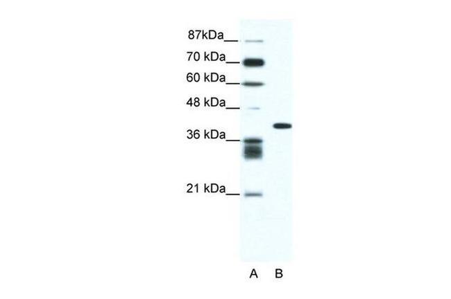ALX4 Antibody in Western Blot (WB)