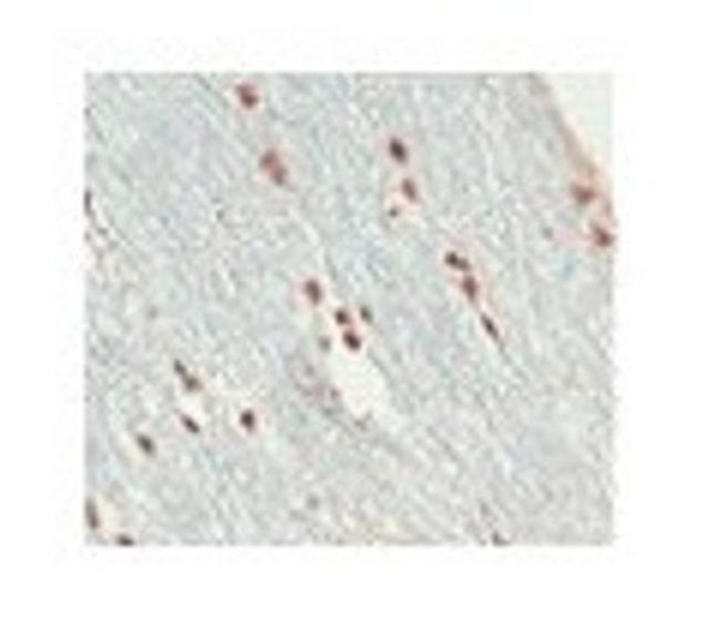 SOX10 Antibody in Immunohistochemistry (Paraffin) (IHC (P))