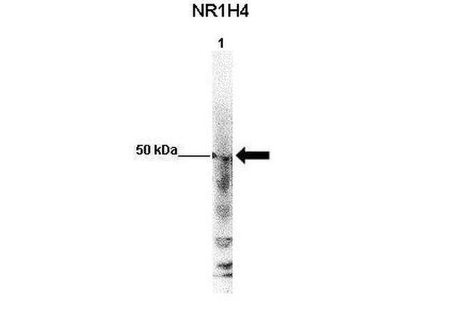 FXR Antibody in Western Blot (WB)