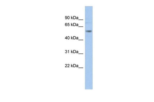 KV1.1 (KCNA1) Antibody in Western Blot (WB)