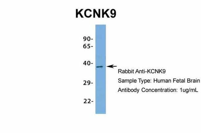 KCNK9 Antibody in Western Blot (WB)