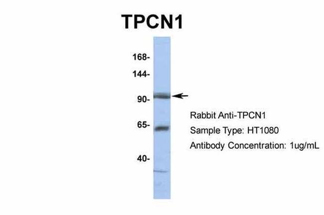 TPCN1 Antibody in Western Blot (WB)