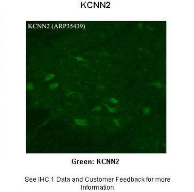 KCNN2 Antibody in Immunohistochemistry (IHC)