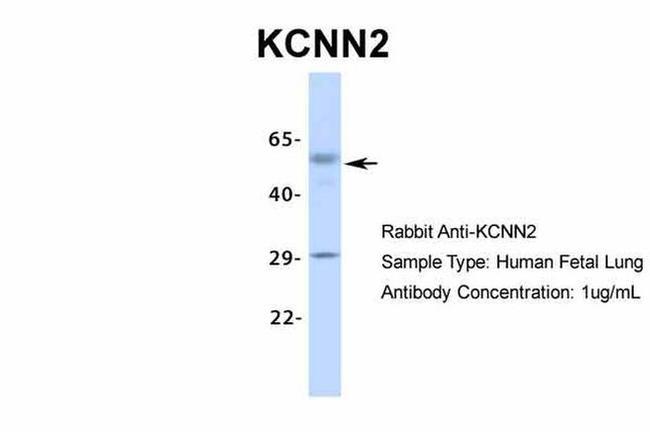 KCNN2 Antibody in Western Blot (WB)