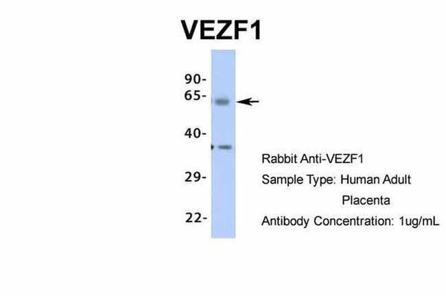 VEZF1 Antibody in Western Blot (WB)