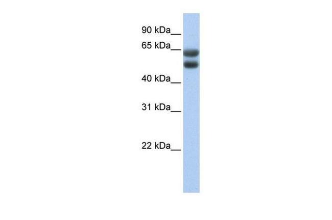 ZNF331 Antibody in Western Blot (WB)