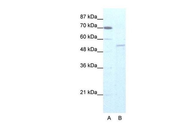 ZNF665 Antibody in Western Blot (WB)