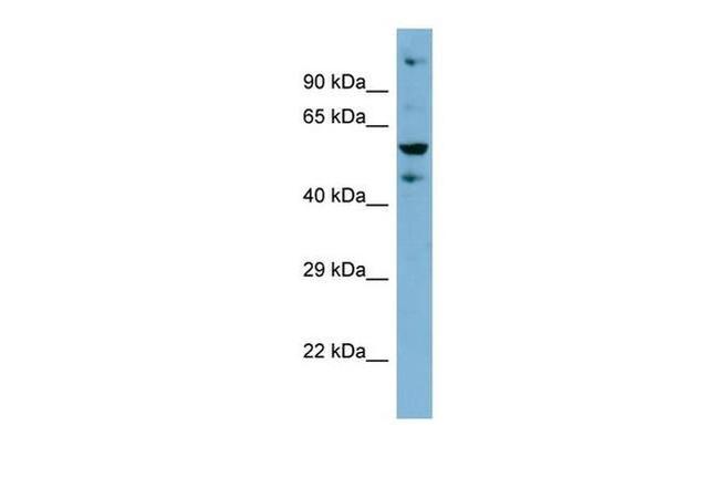 ZNF573 Antibody in Western Blot (WB)