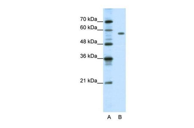 PBX2 Antibody in Western Blot (WB)