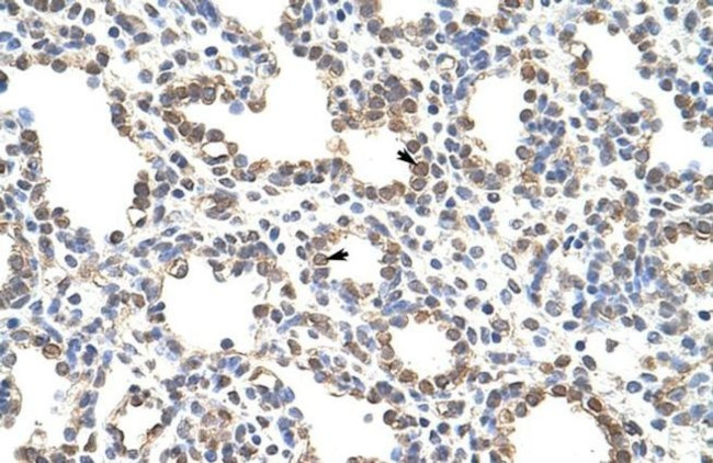 ZNF195 Antibody in Immunohistochemistry (IHC)
