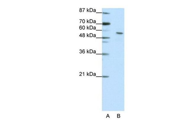 IA-6 Antibody in Western Blot (WB)