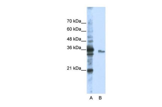 EXOSC3 Antibody in Western Blot (WB)