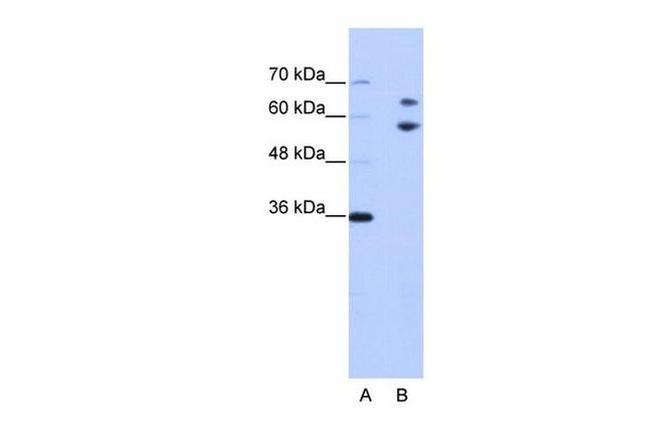 TROVE2 Antibody in Western Blot (WB)