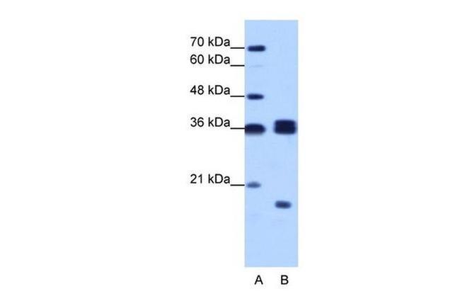 hnRNP H3 Antibody in Western Blot (WB)