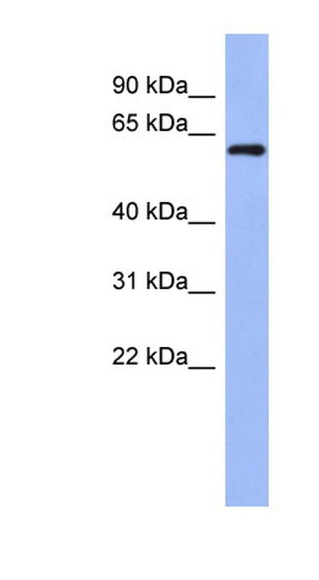 RBM47 Antibody in Western Blot (WB)