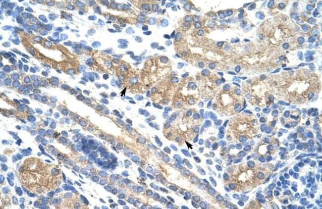RPUSD2 Antibody in Immunohistochemistry (Paraffin) (IHC (P))
