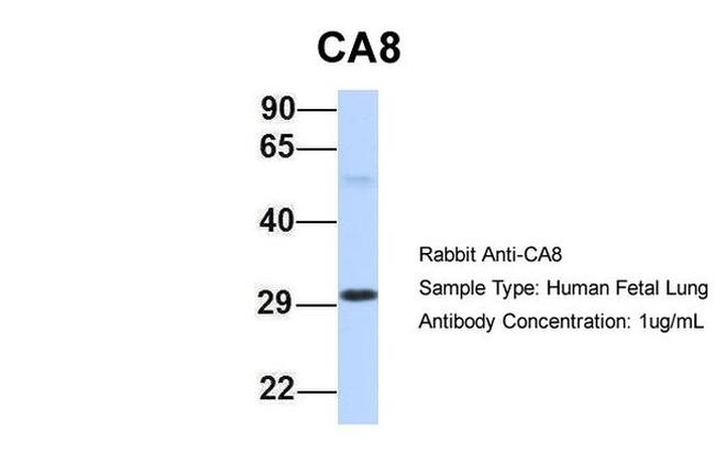 Carbonic Anhydrase VIII Antibody in Western Blot (WB)