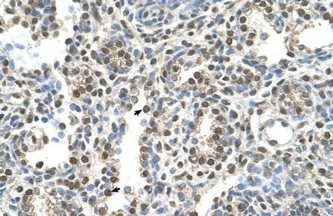 MAGEA8 Antibody in Immunohistochemistry (Paraffin) (IHC (P))