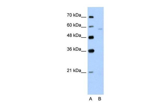 SLC22A7 Antibody in Western Blot (WB)