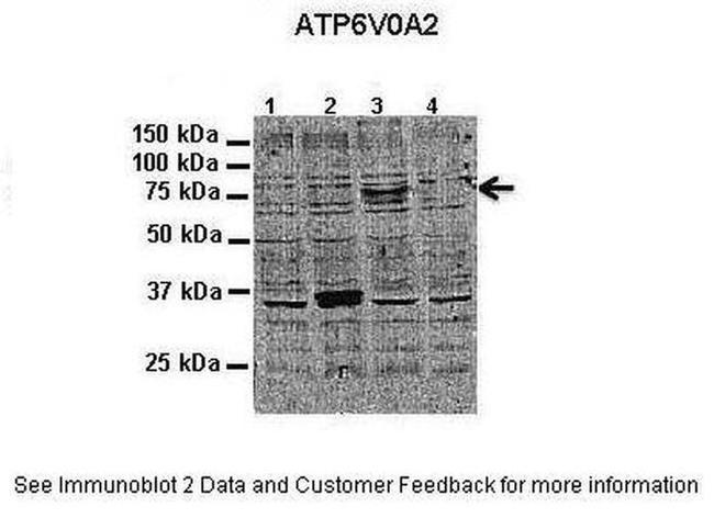 ATP6V0A2 Antibody in Western Blot (WB)
