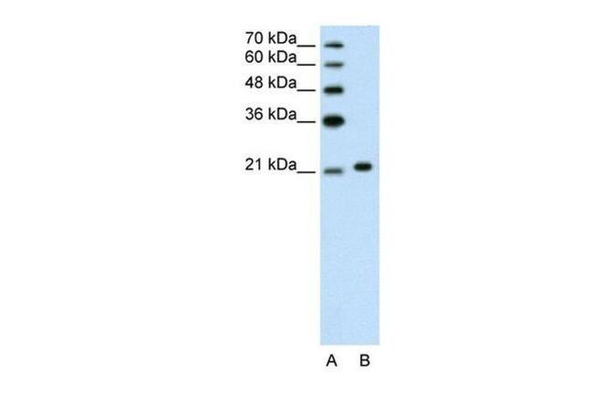 Ankyrin 1 Antibody in Western Blot (WB)