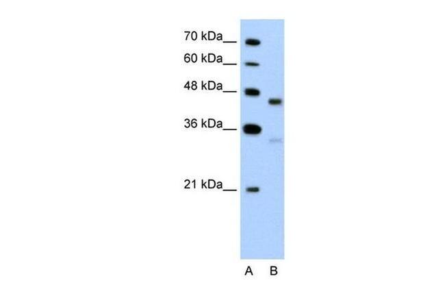 GPR161 Antibody in Western Blot (WB)